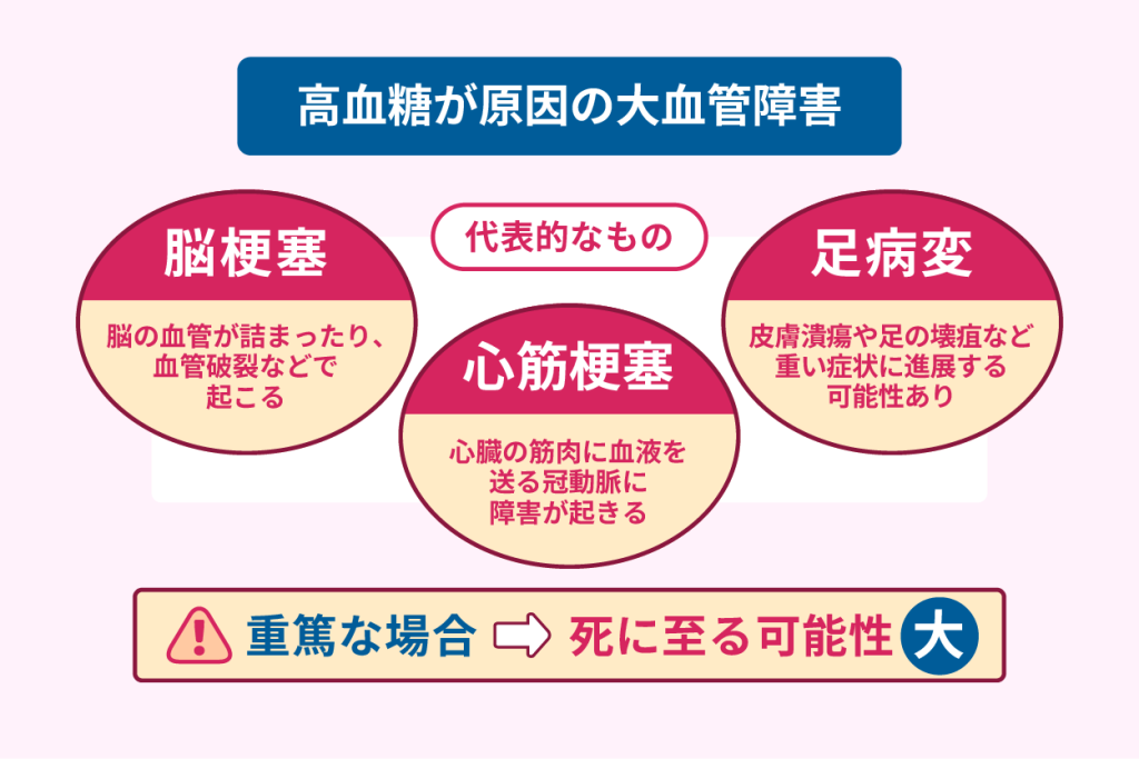 高血糖が原因の大血管障害