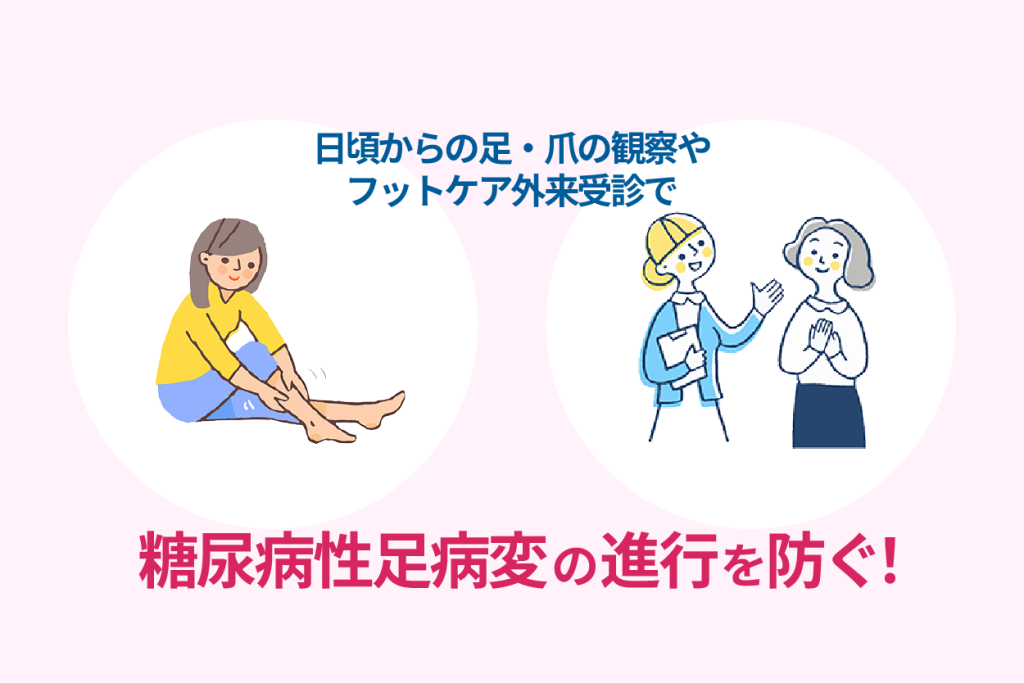 日頃からの足・爪の観察やフットケア外来受診で糖尿病性足病変の進行を防ぐ