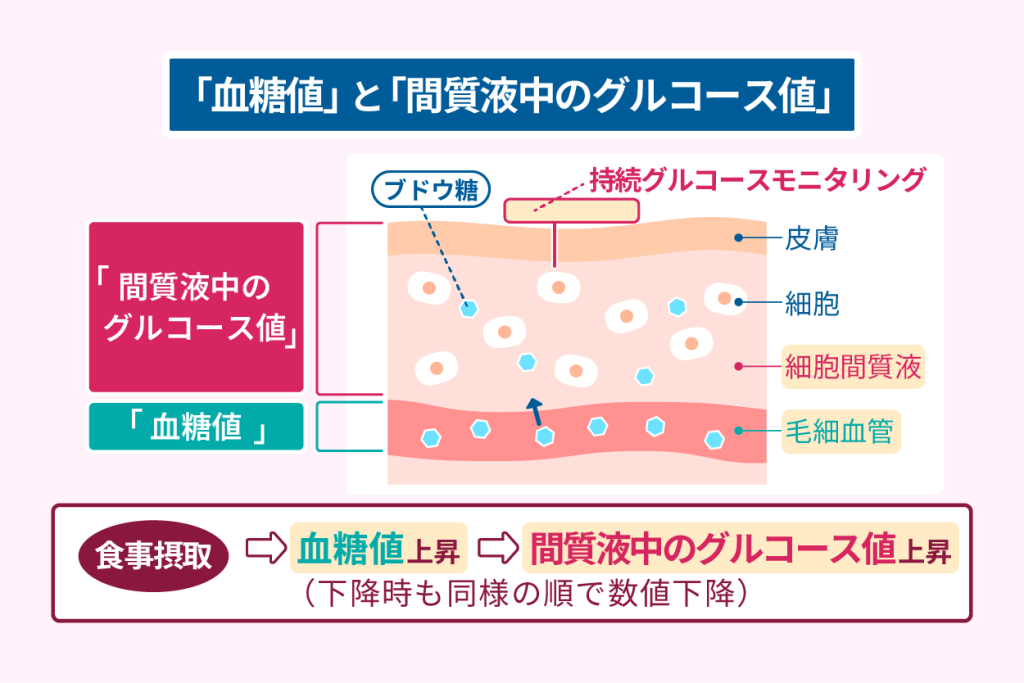 血糖値と間質液中のグルコース値