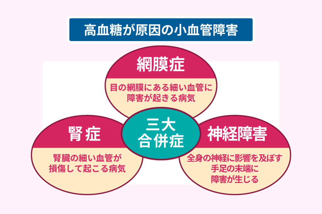 高血糖が原因の小血管障害