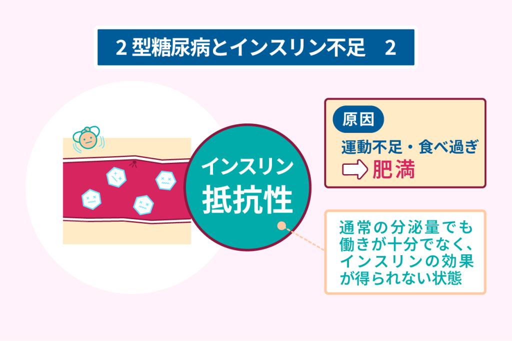 ２型糖尿病とインスリン不足２