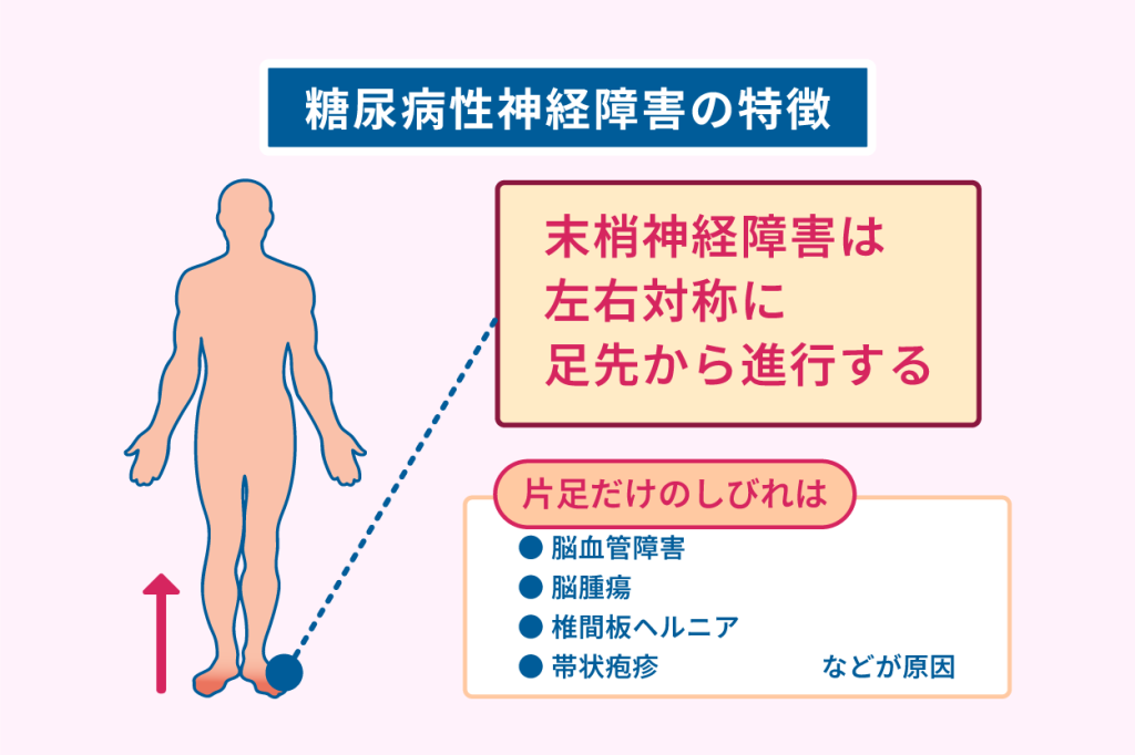 糖尿病性神経障害の特徴