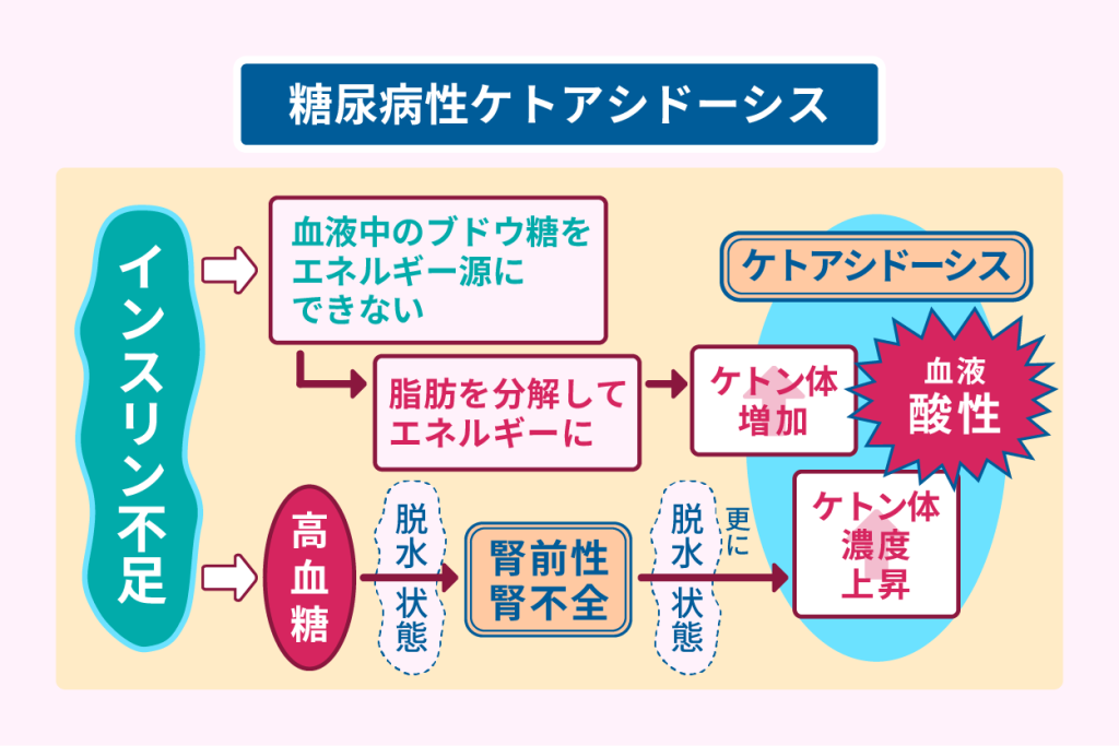 糖尿病性ケトアシドーシス