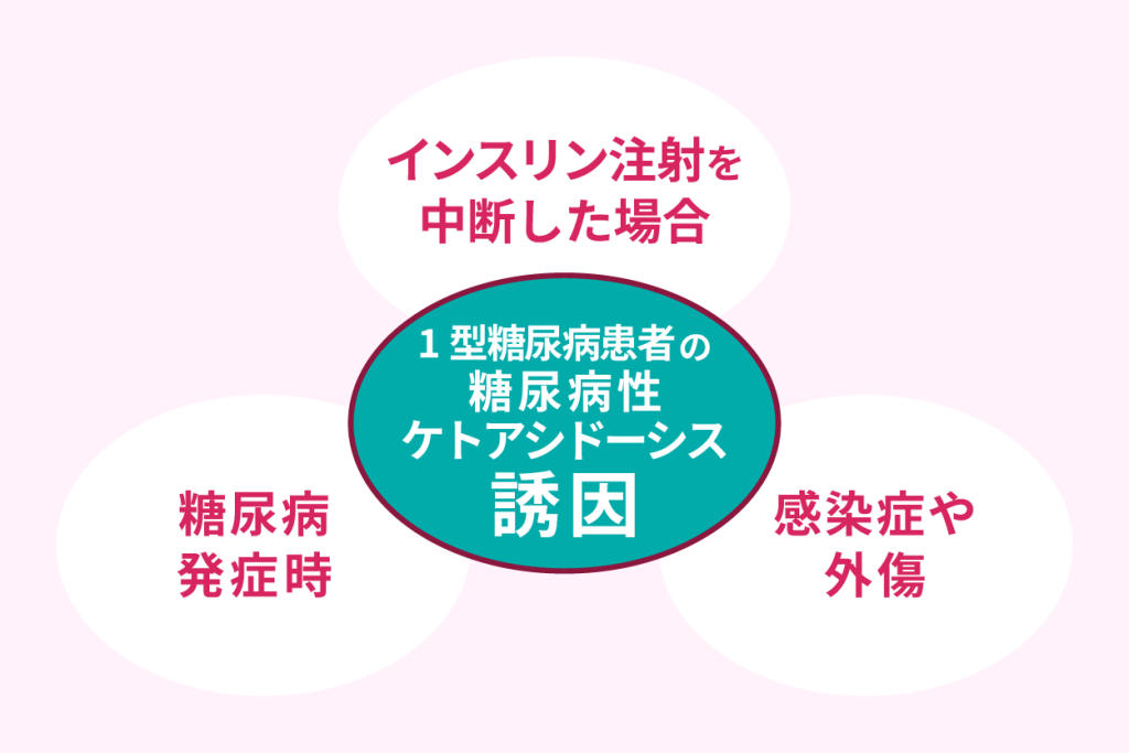 １型糖尿病患者の糖尿病性ケトアシドーシス誘因